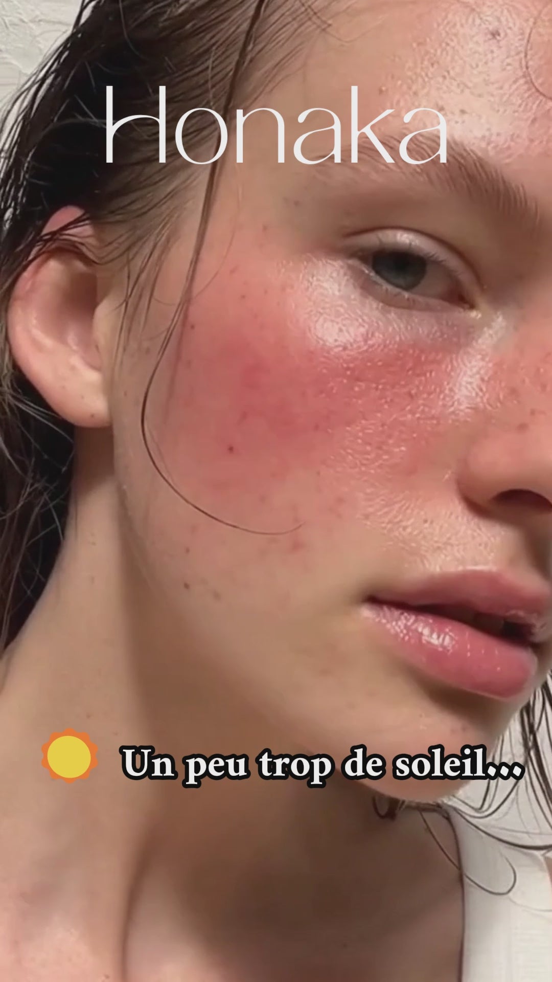 Vidéo